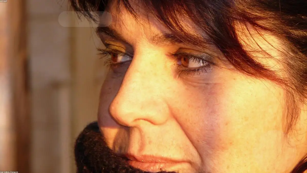 Hur länge håller botox? 3–6 månader [Komplett 2026-guide] - botox i estetisk klinik